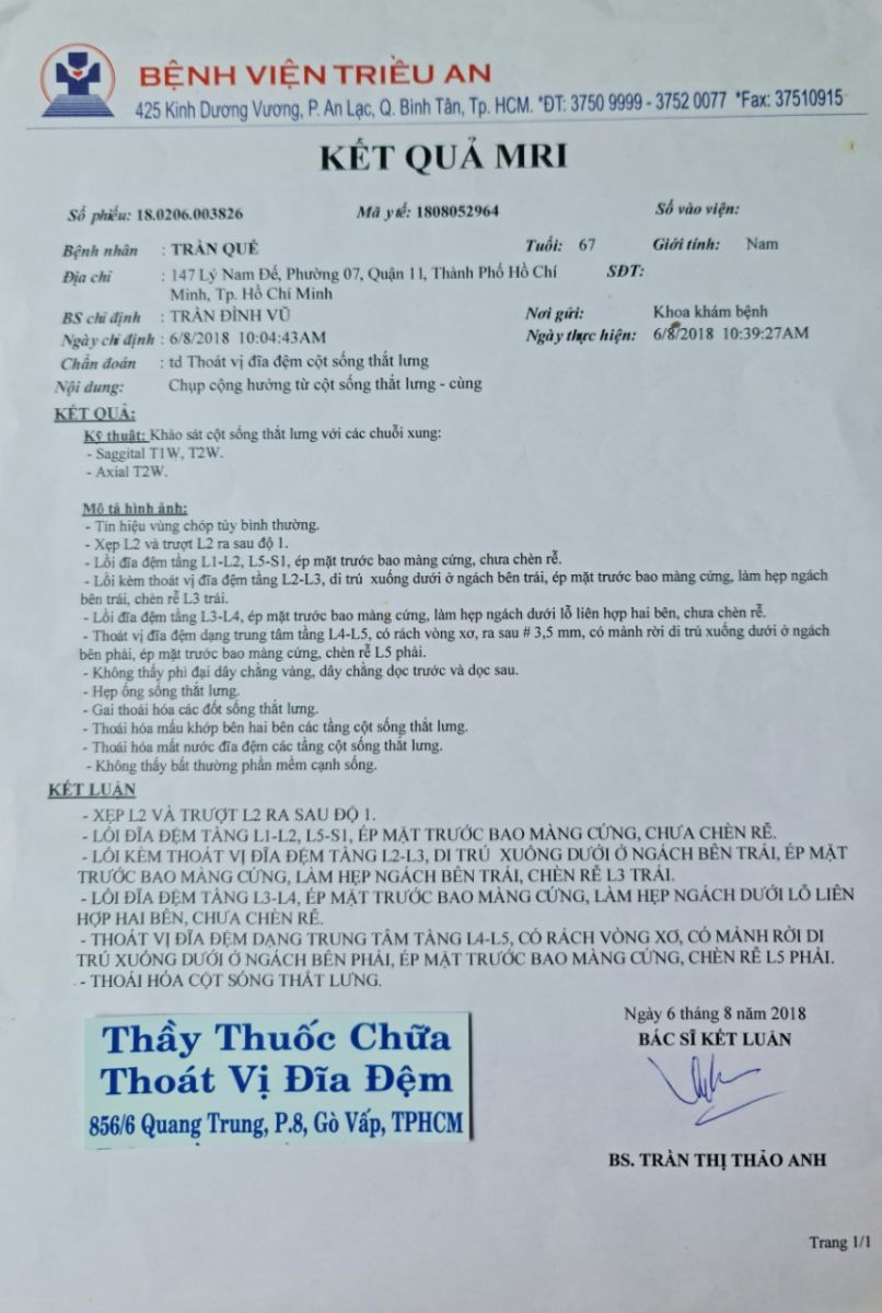 Thầy thuốc chữa thoát vị đĩa đệm
